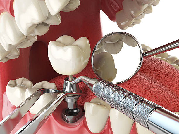Best Weekend Emergency Dentist in Riverbend, WA